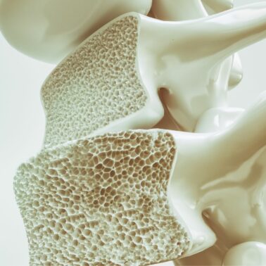 Post image How Older Australians Can Benefit from Early Osteoporosis Screening