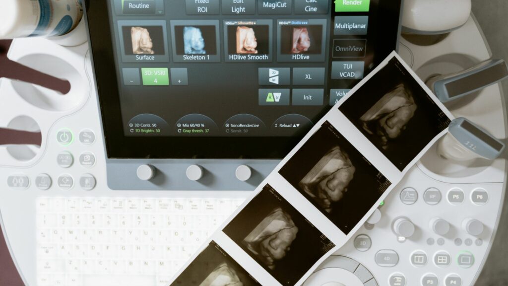 3d ultrasound results