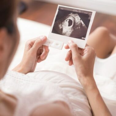 Post image Dating Scan: Your Guide to Early Pregnancy Ultrasounds